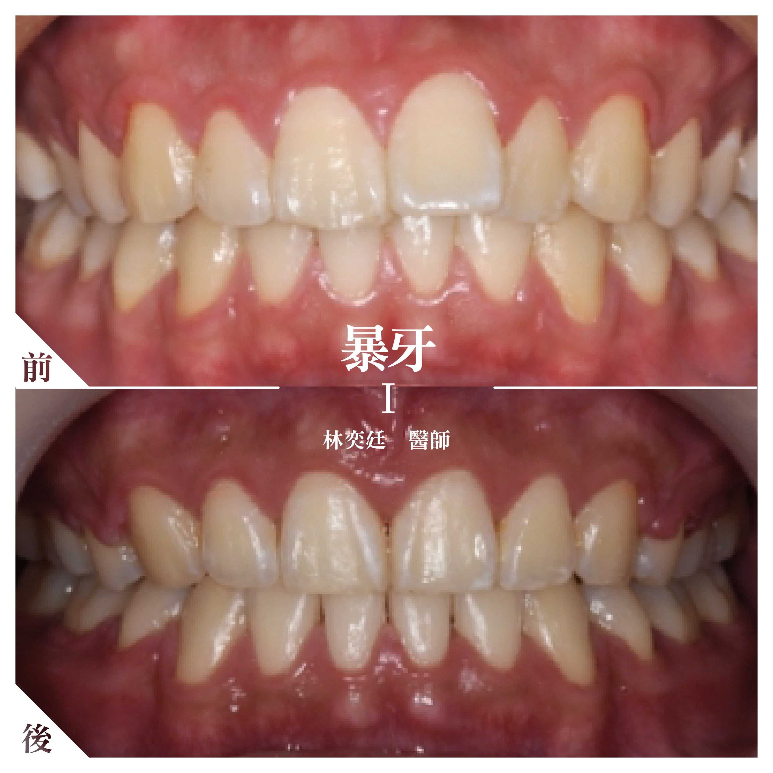 案例-1