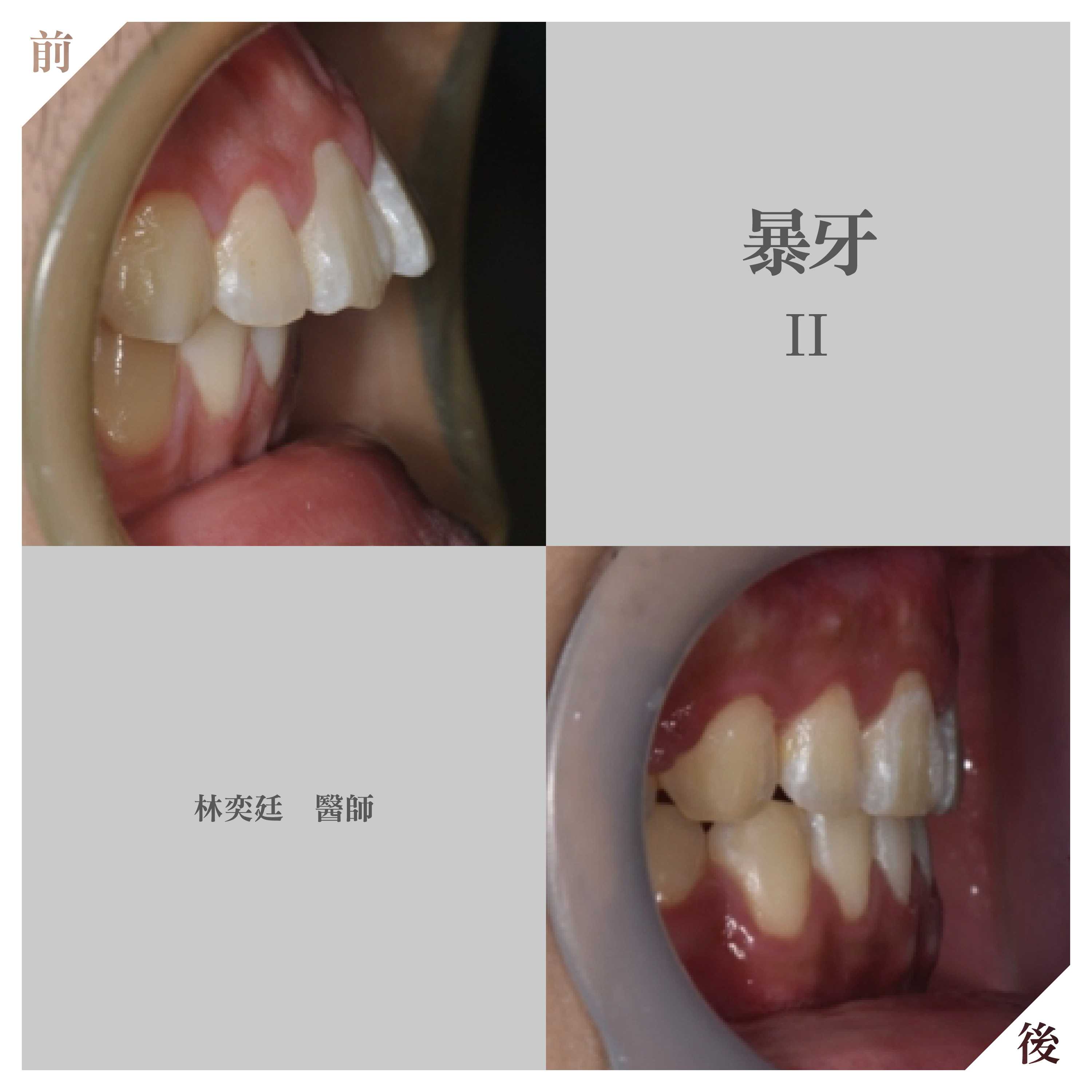 案例-2