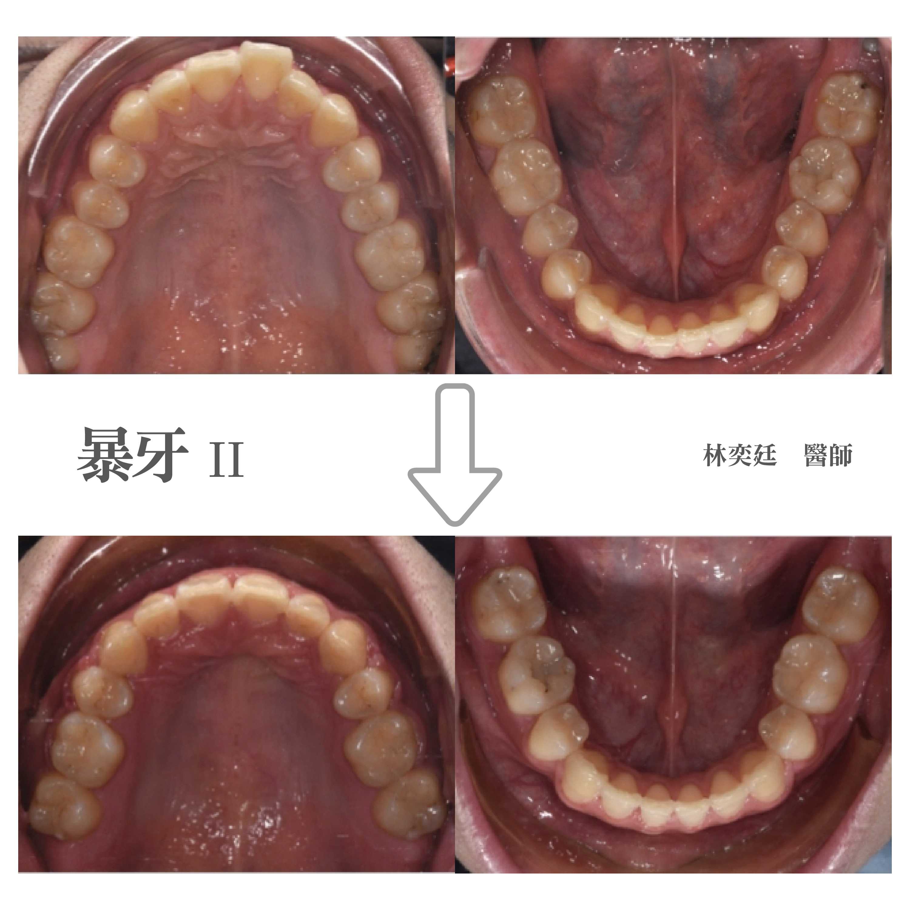 案例-3