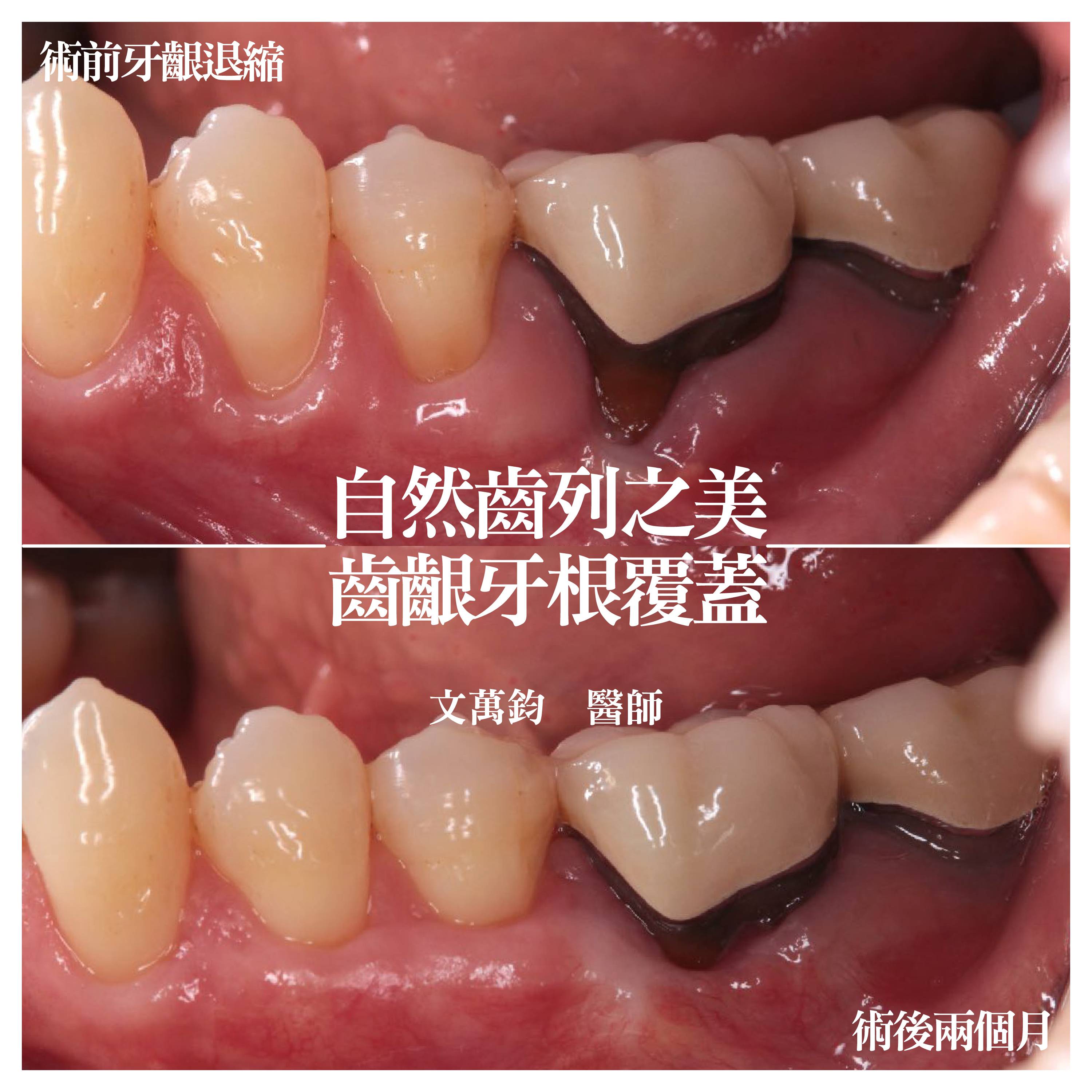 案例-0