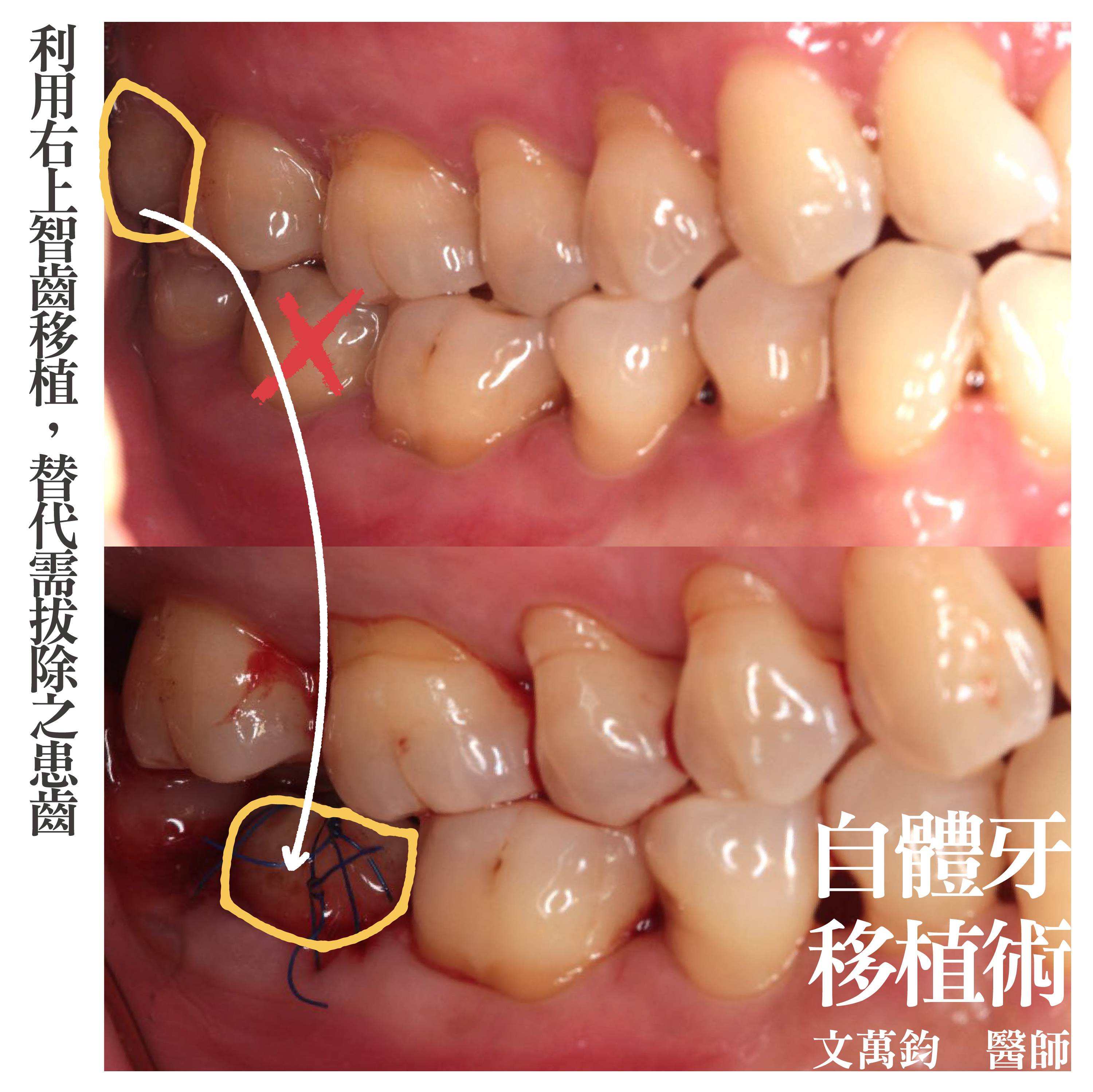 案例-1