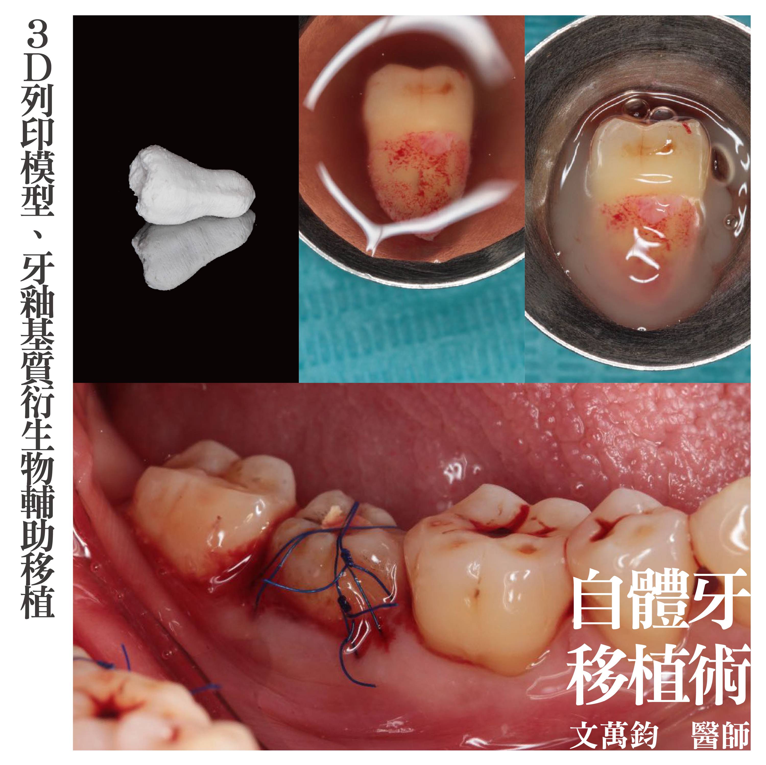 案例-2