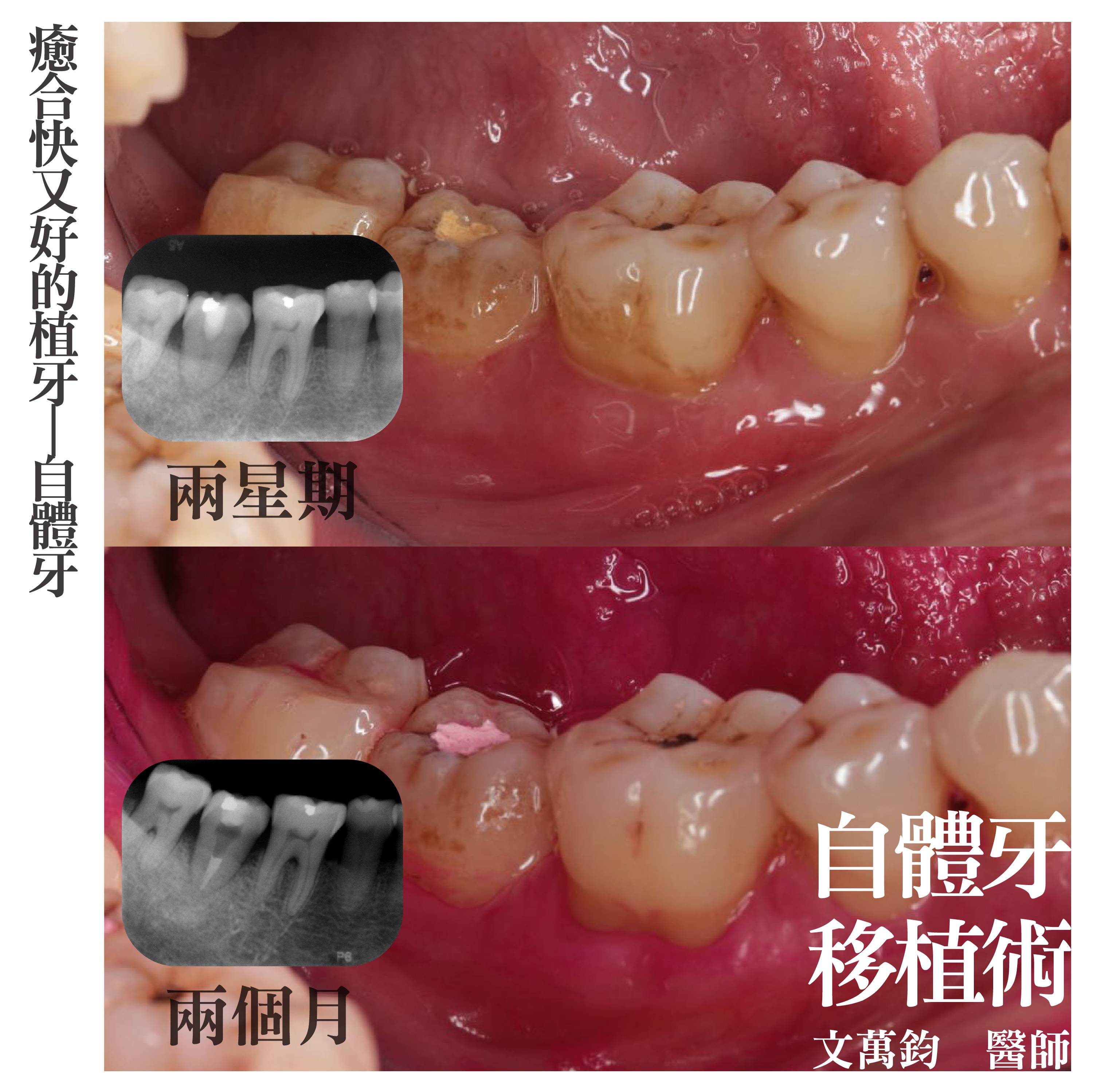 案例-3