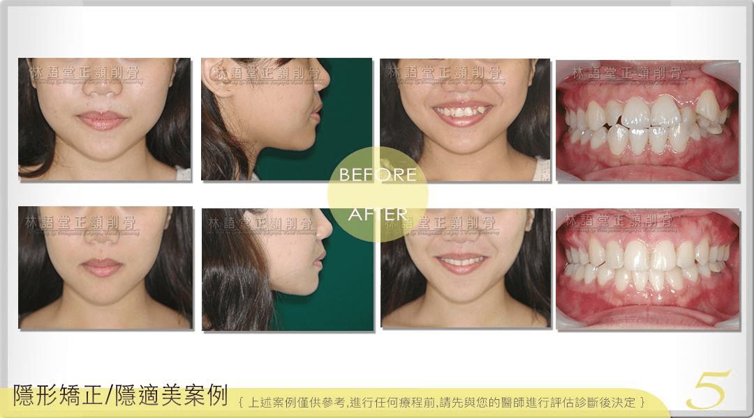 案例-1