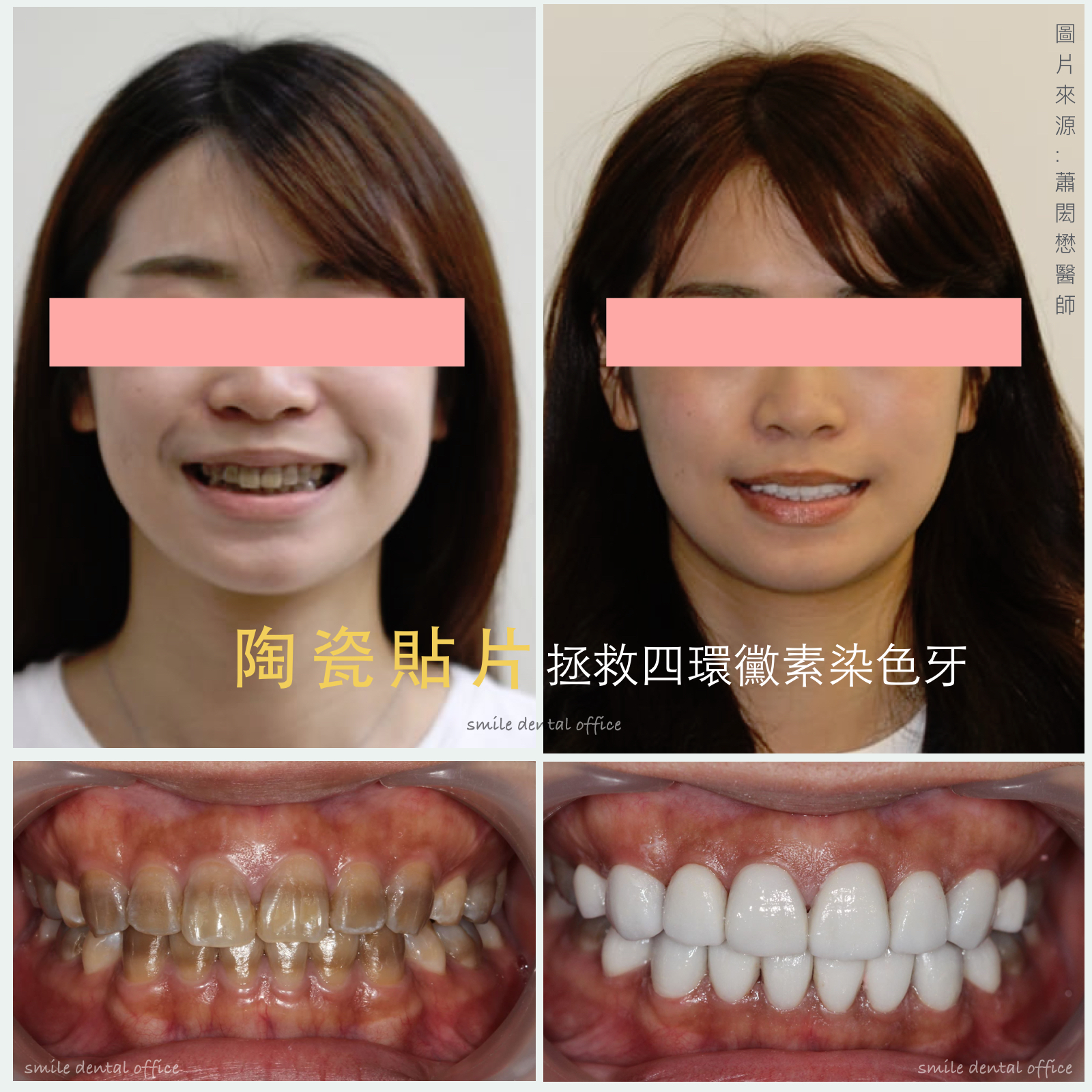 案例-0