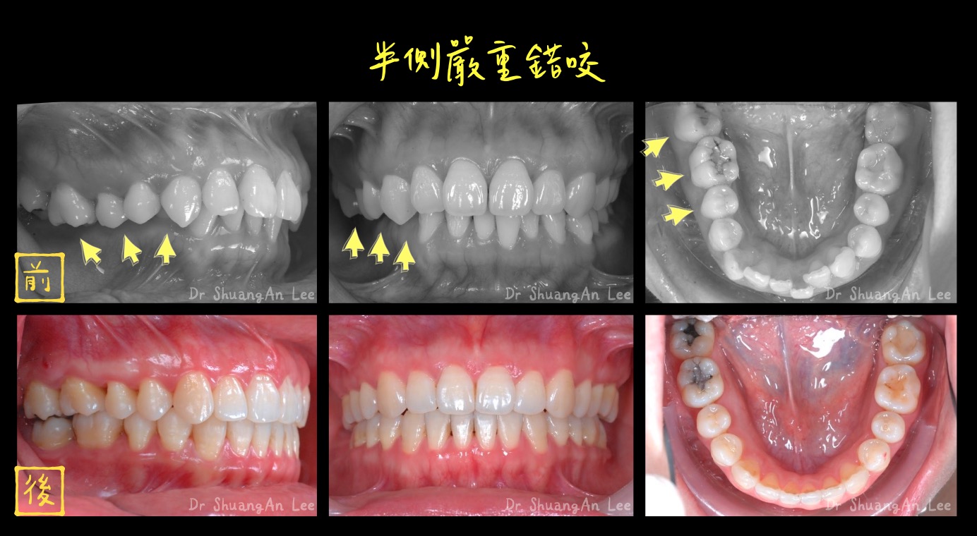 案例-0