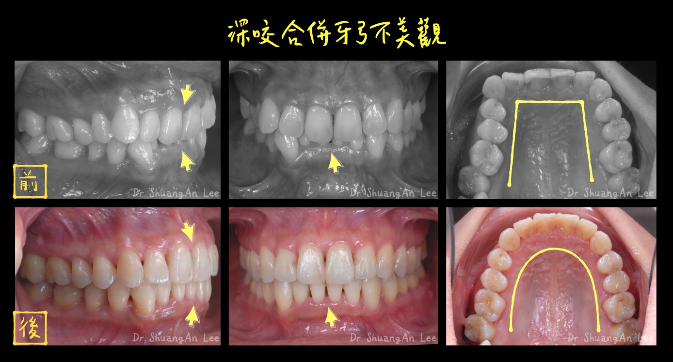 案例-3