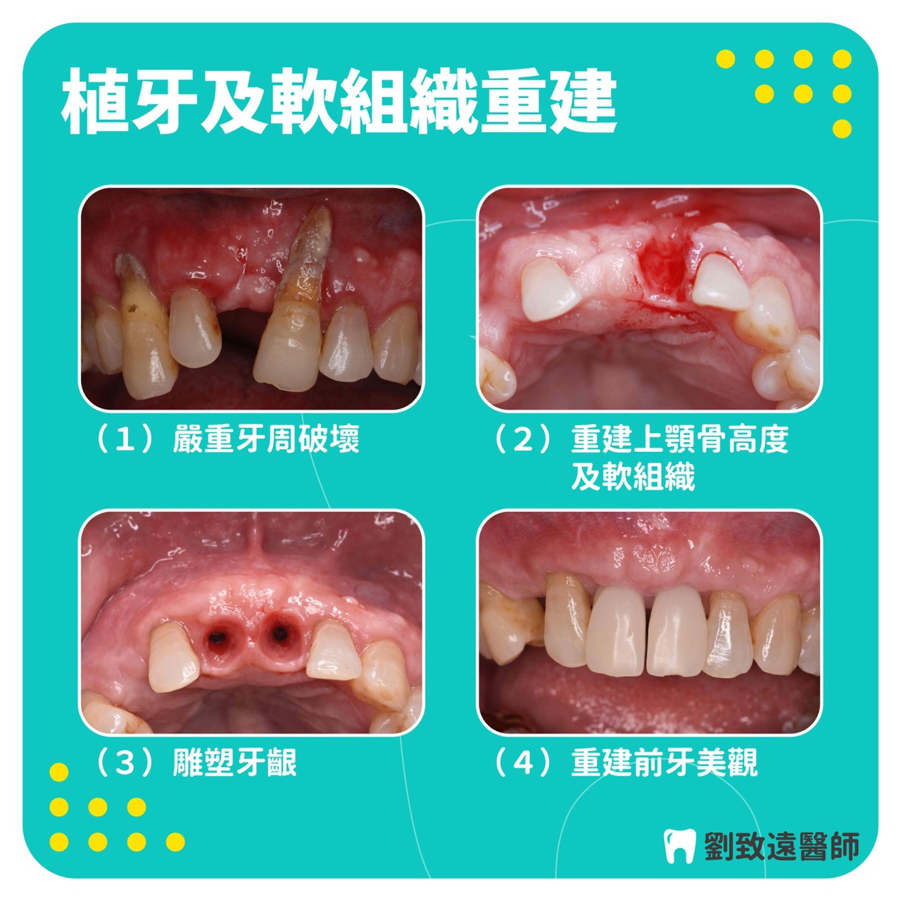 案例-1