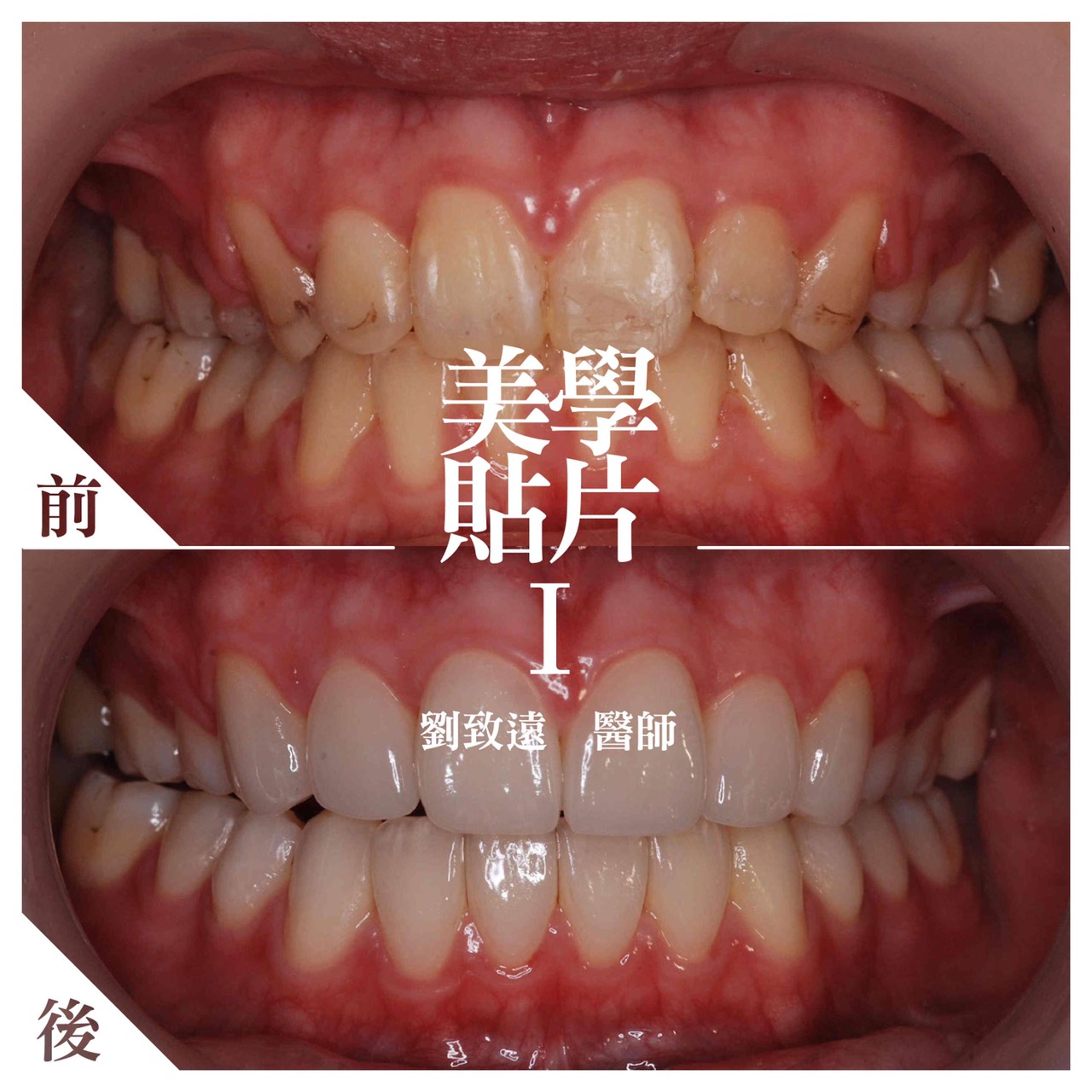 案例-3