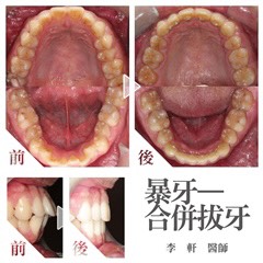 案例-0