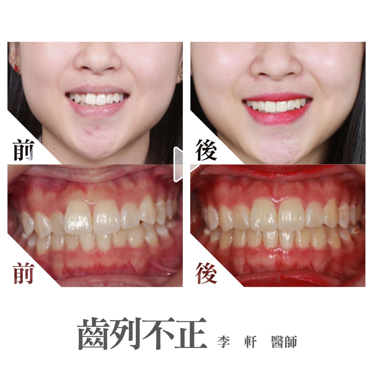 案例-3
