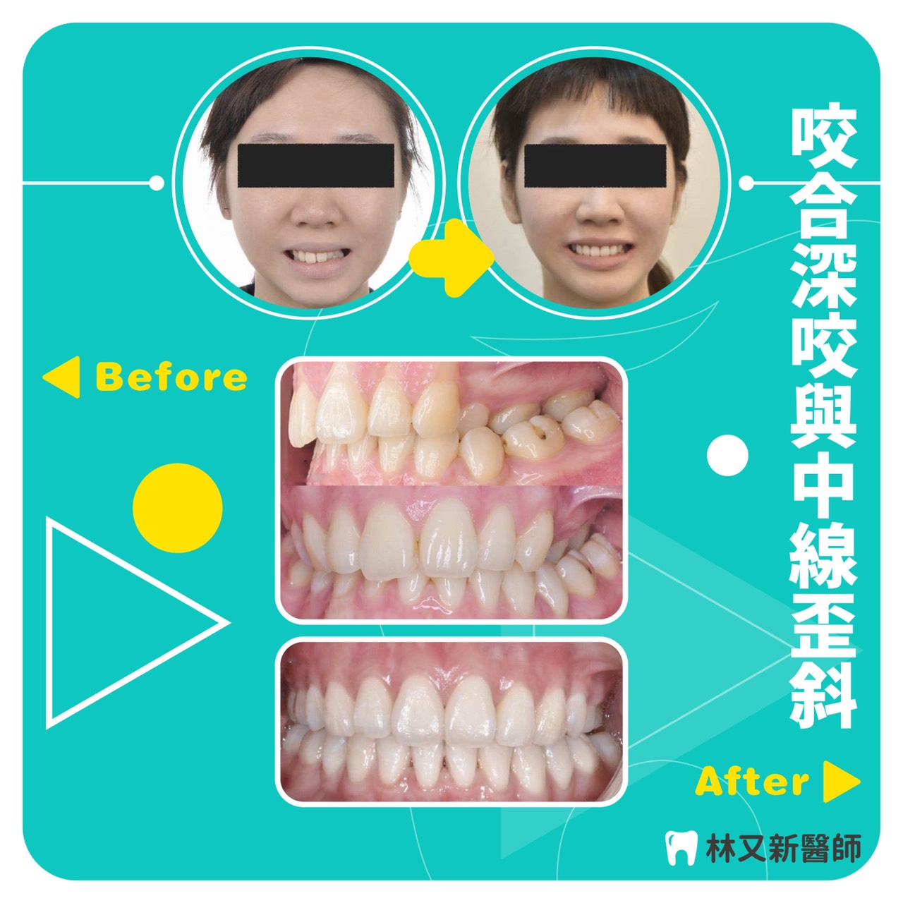 案例-3