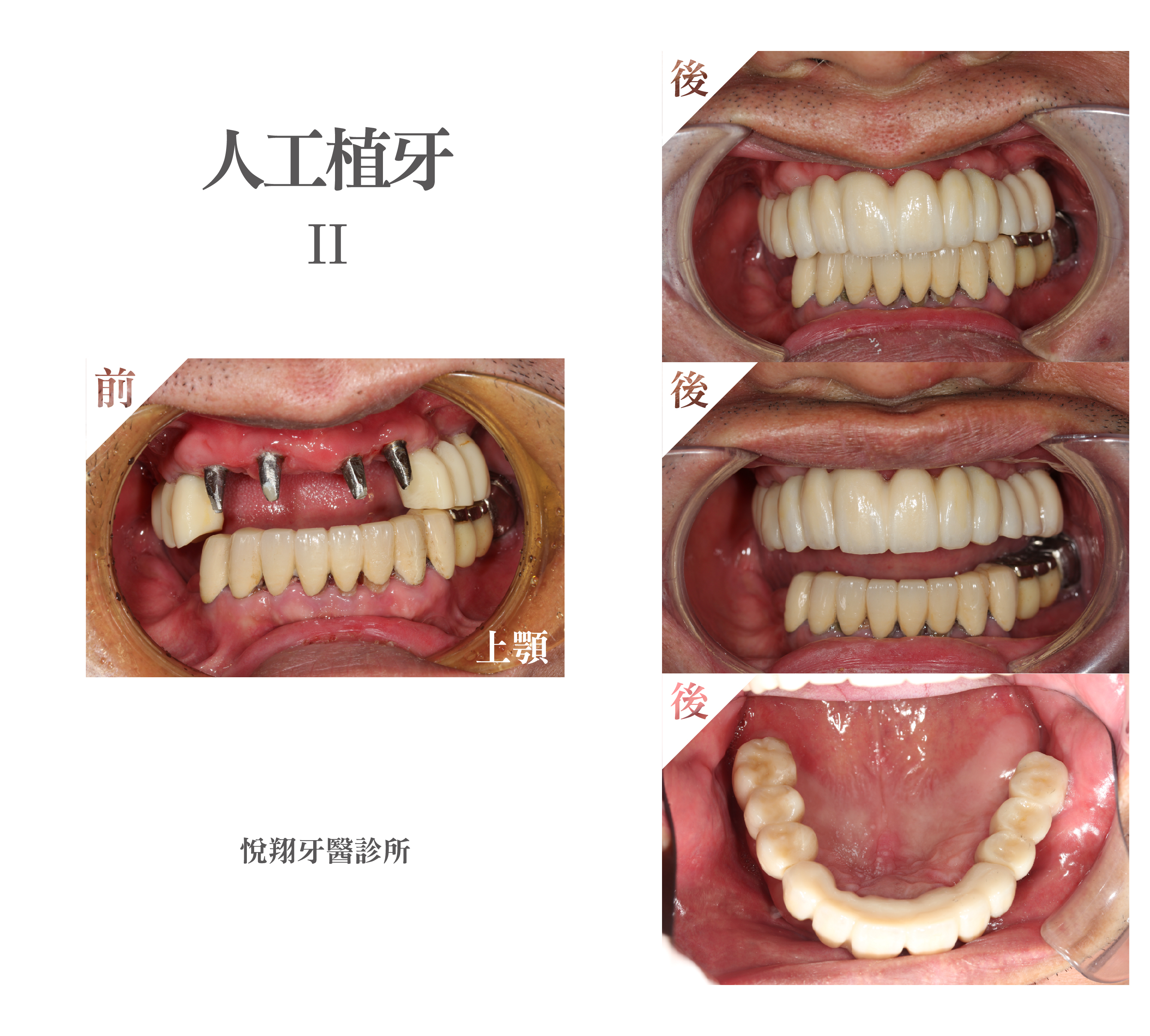 案例-1