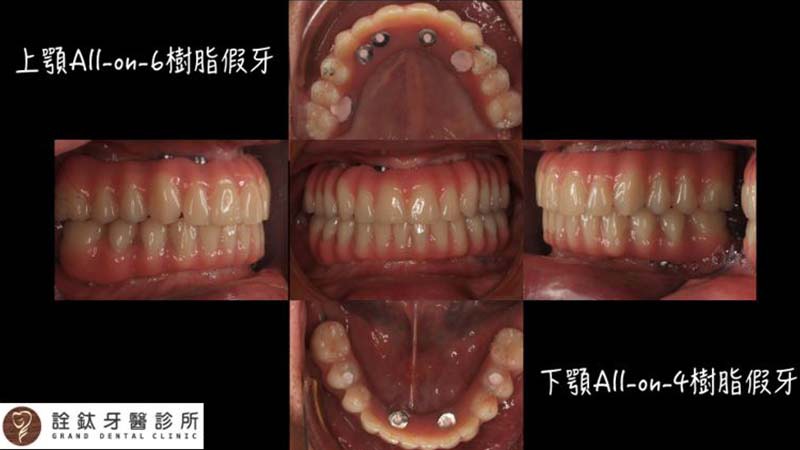 案例-0