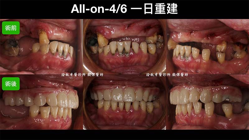 案例-3