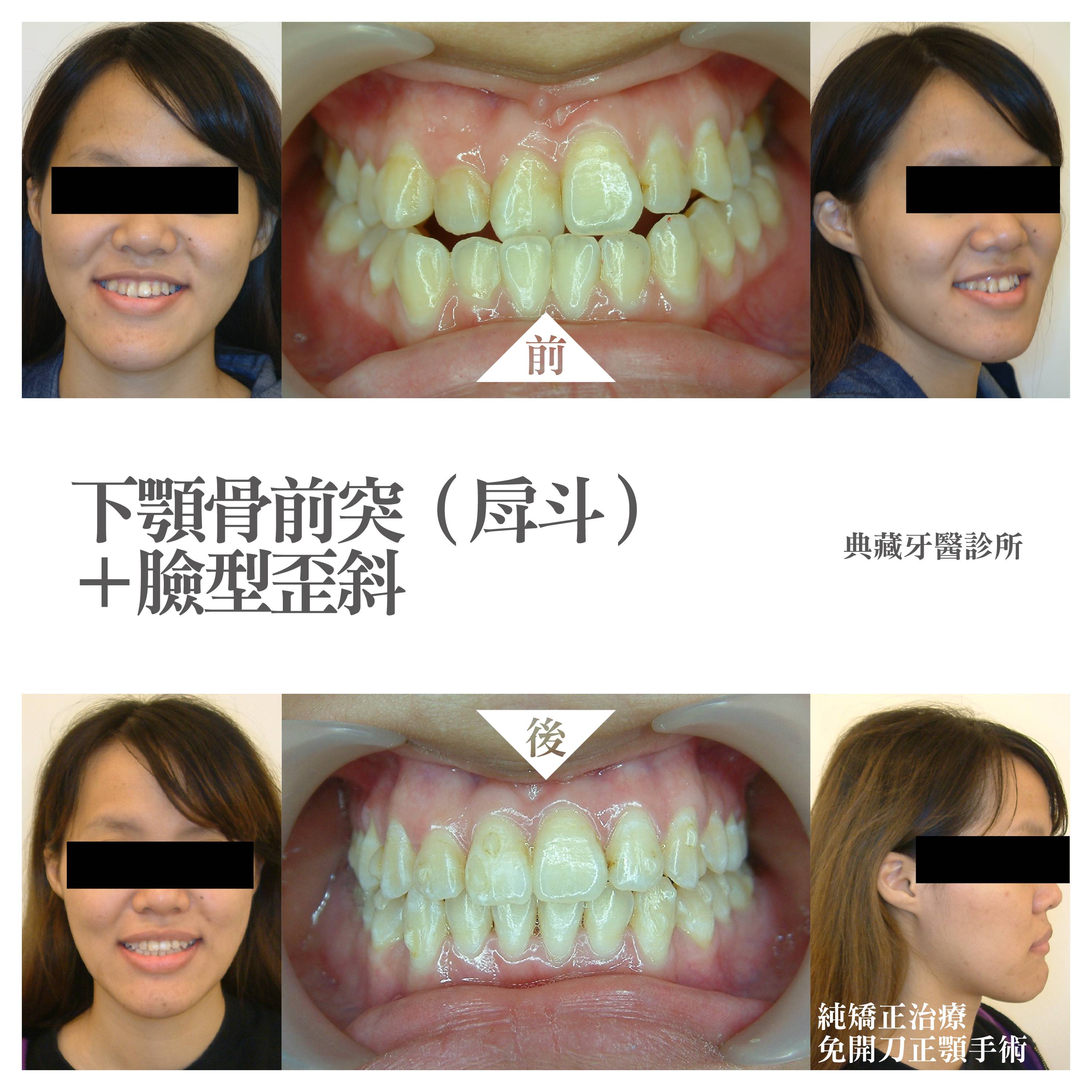 案例-1