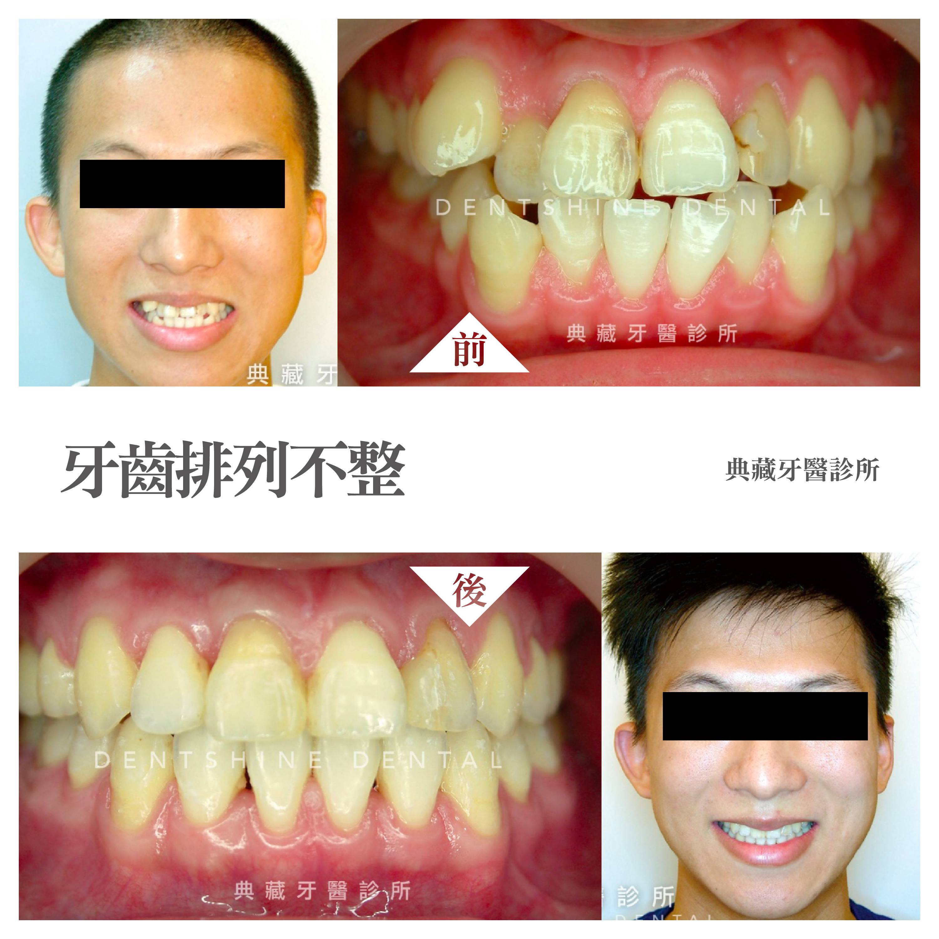 案例-2