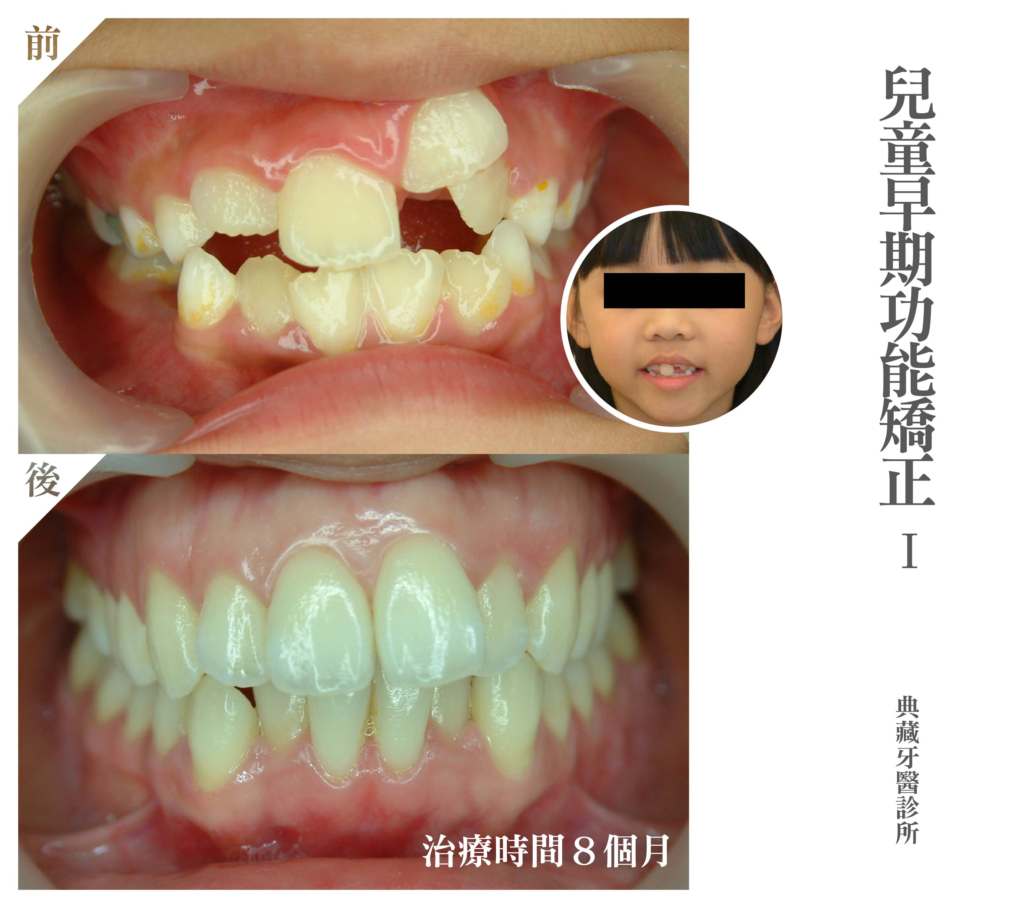 案例-3