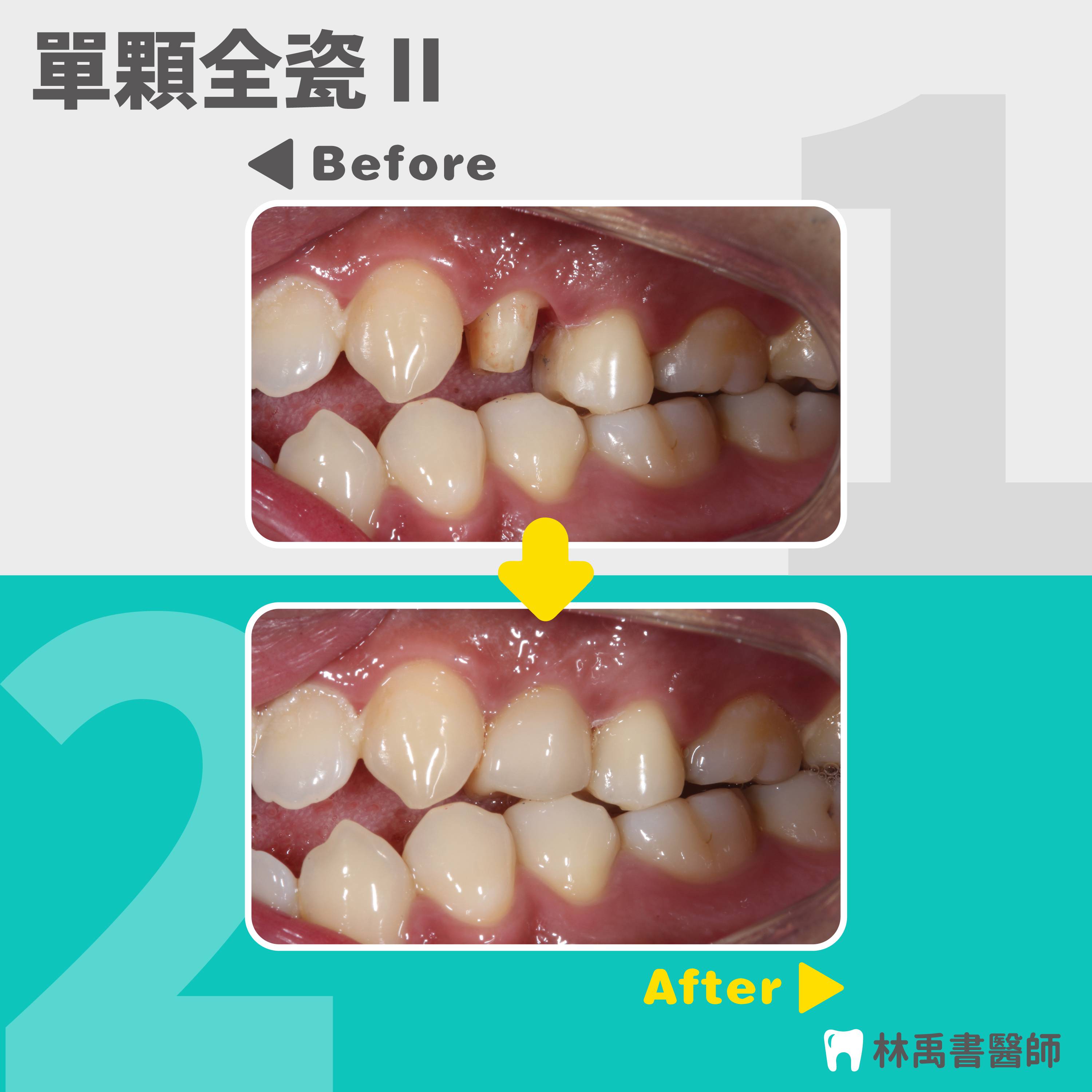 案例-2
