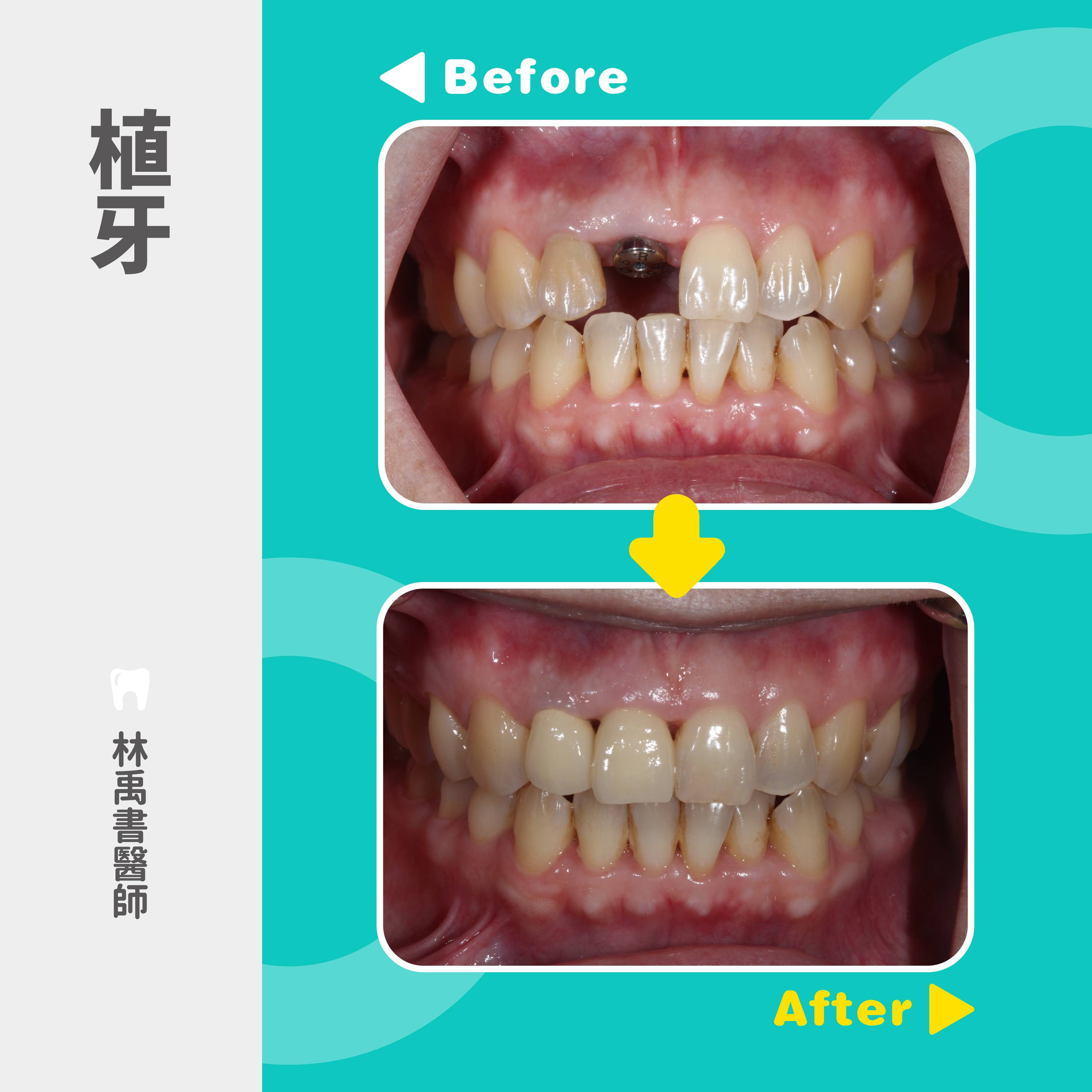 案例-3
