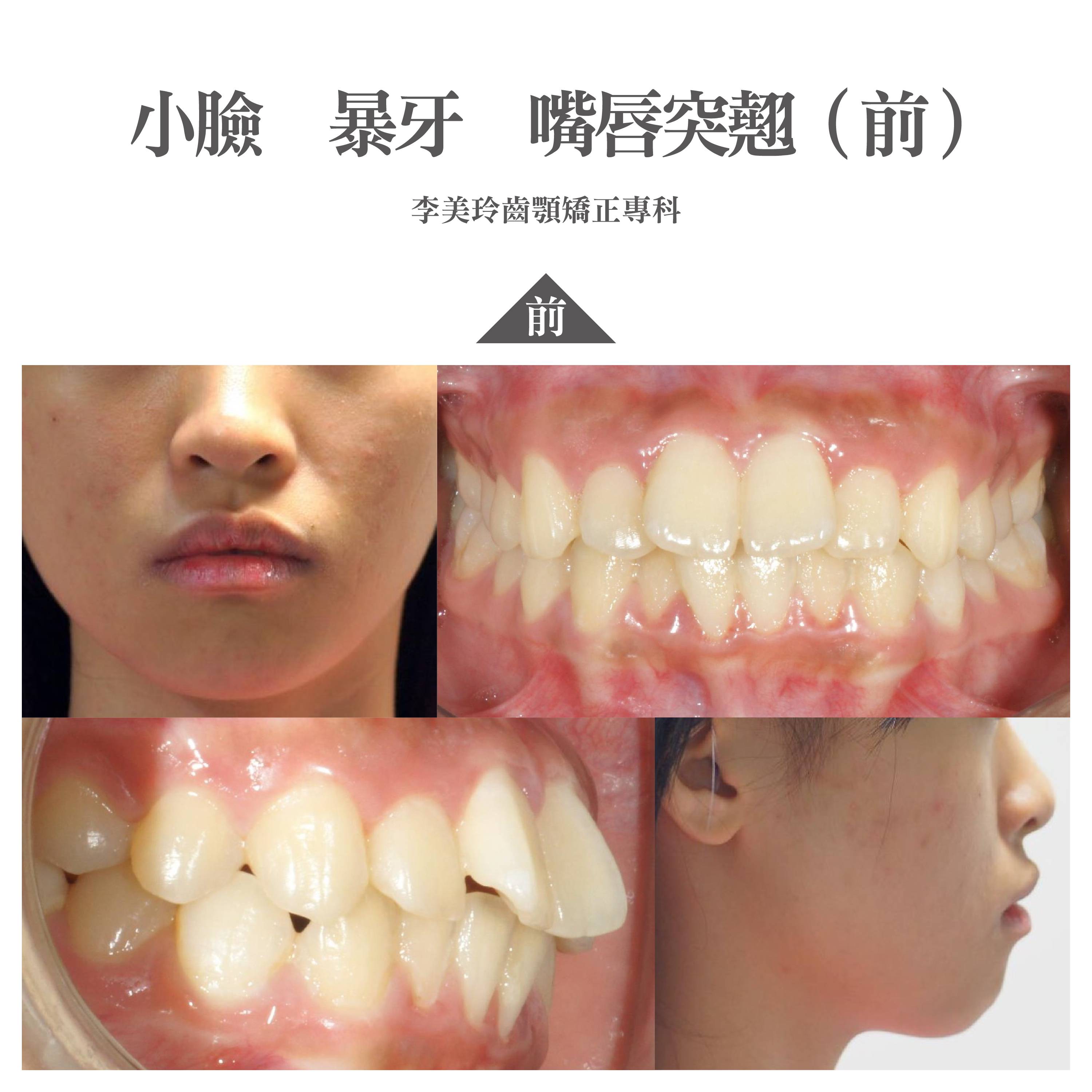 案例-0