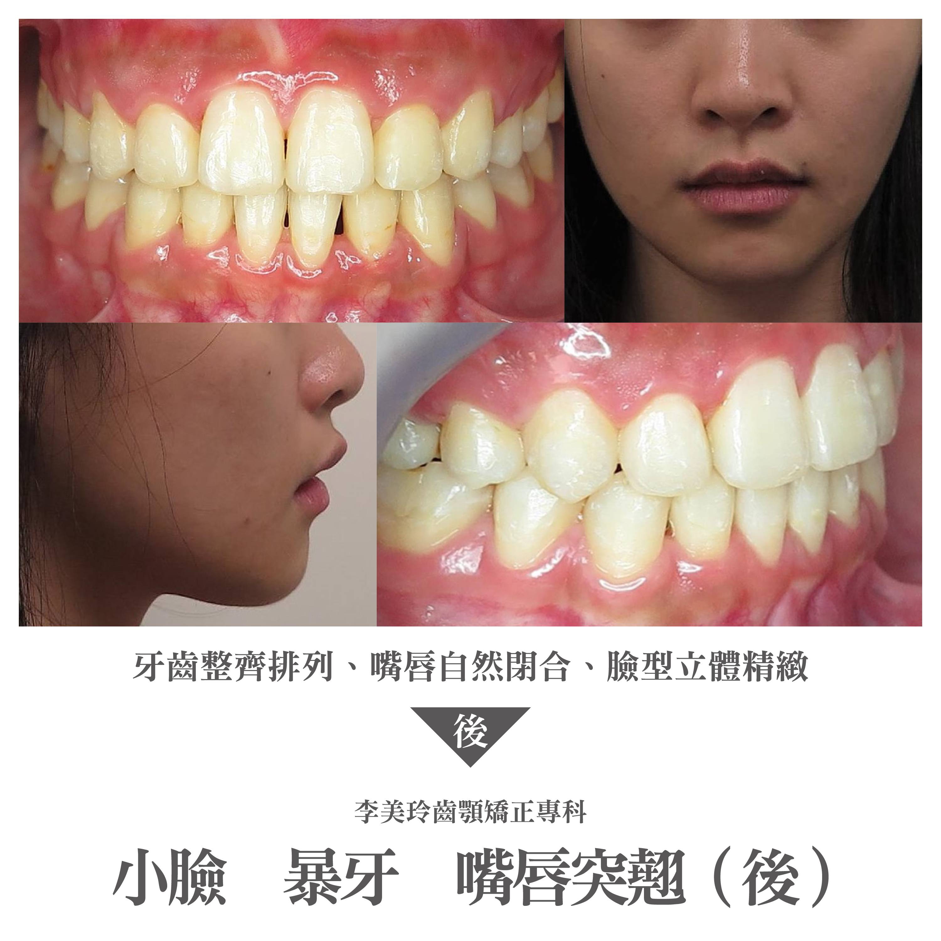 案例-1
