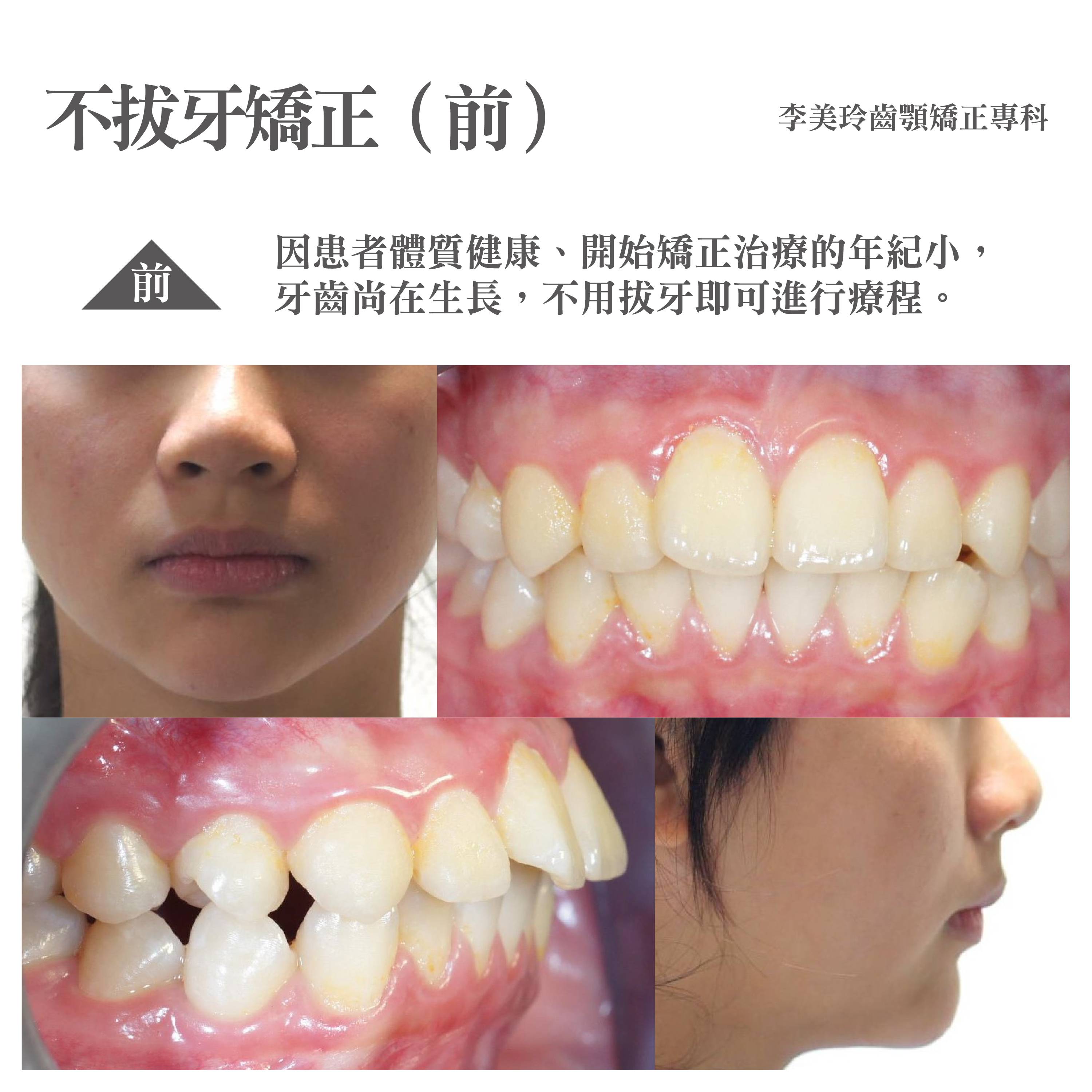 案例-2