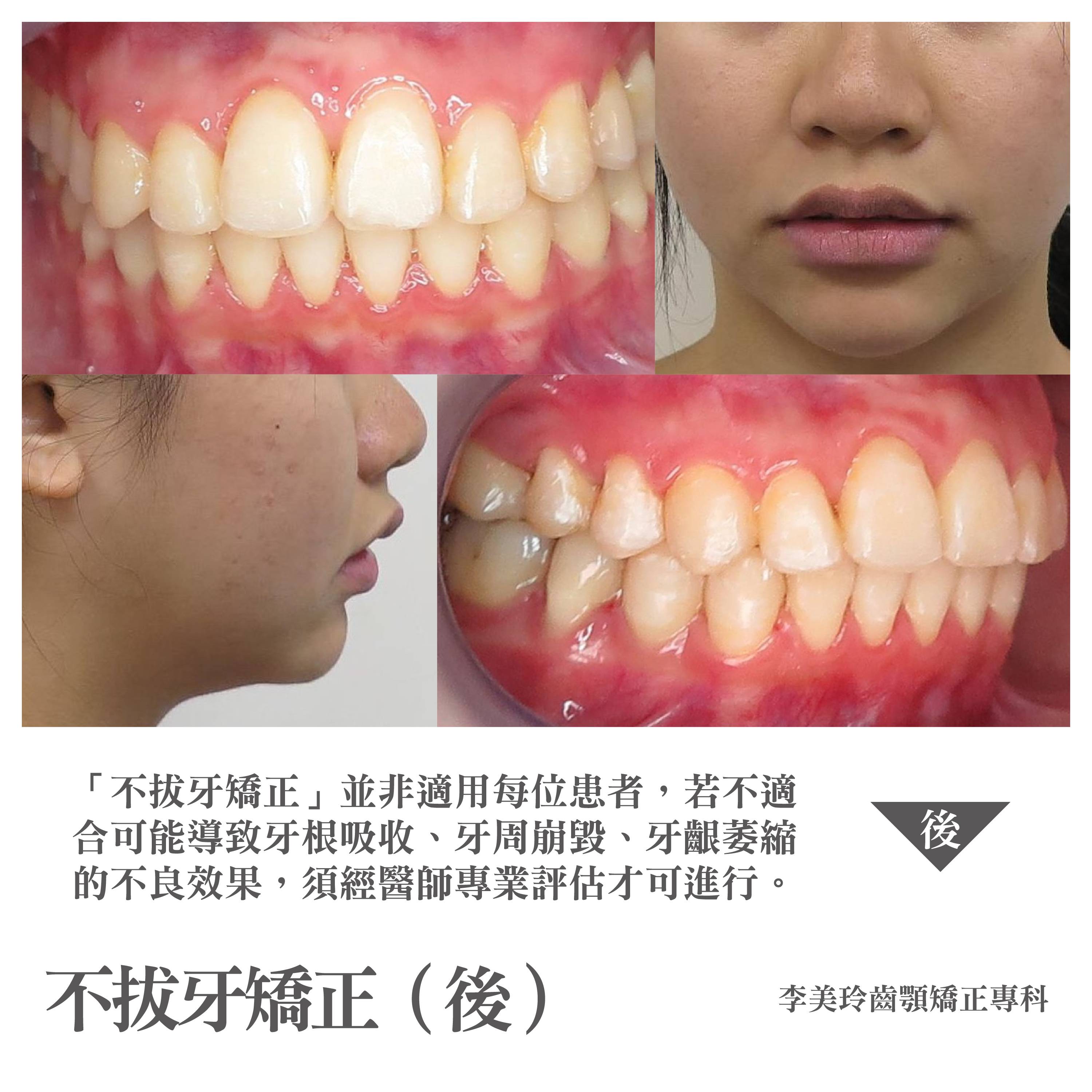 案例-3