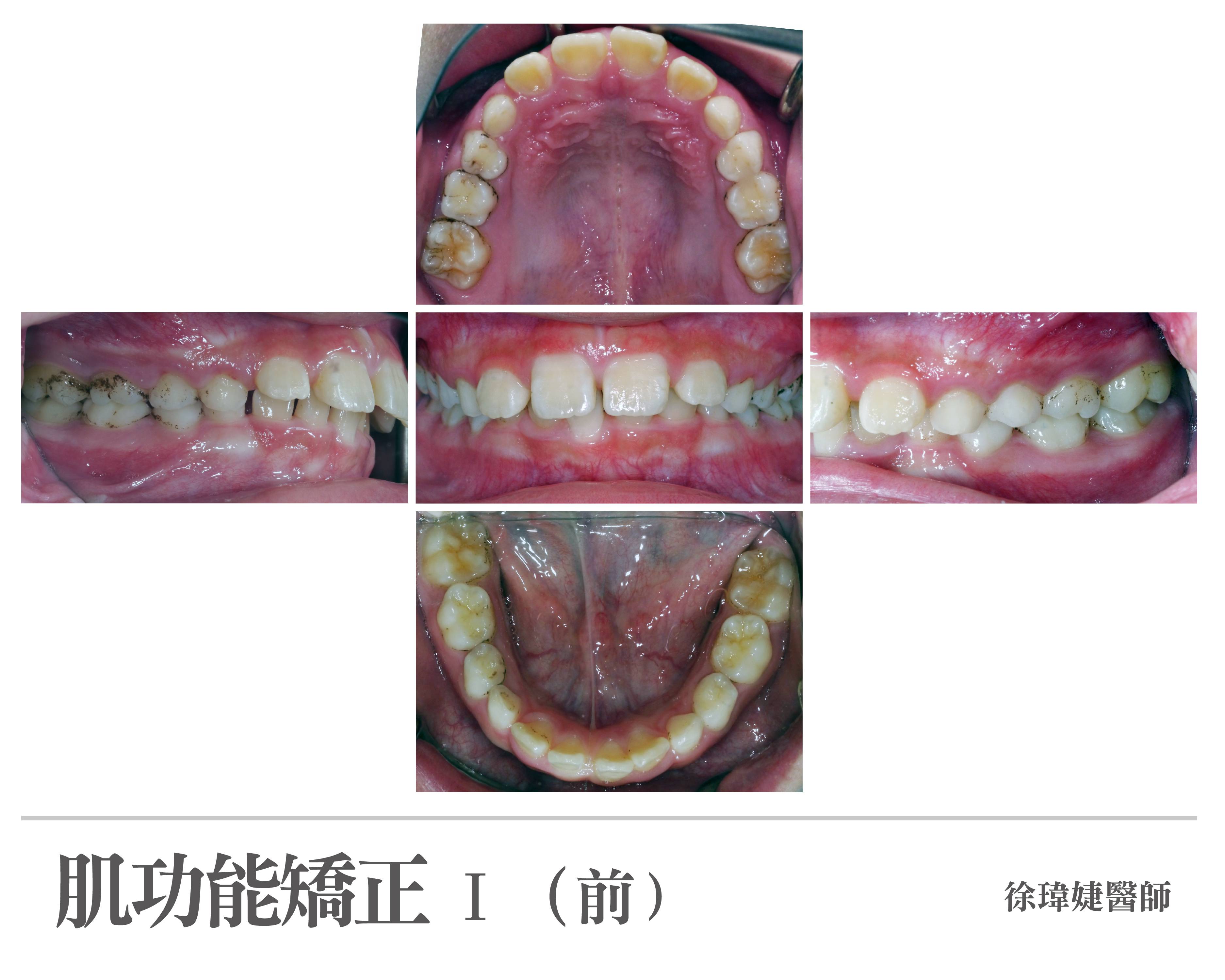 案例-0