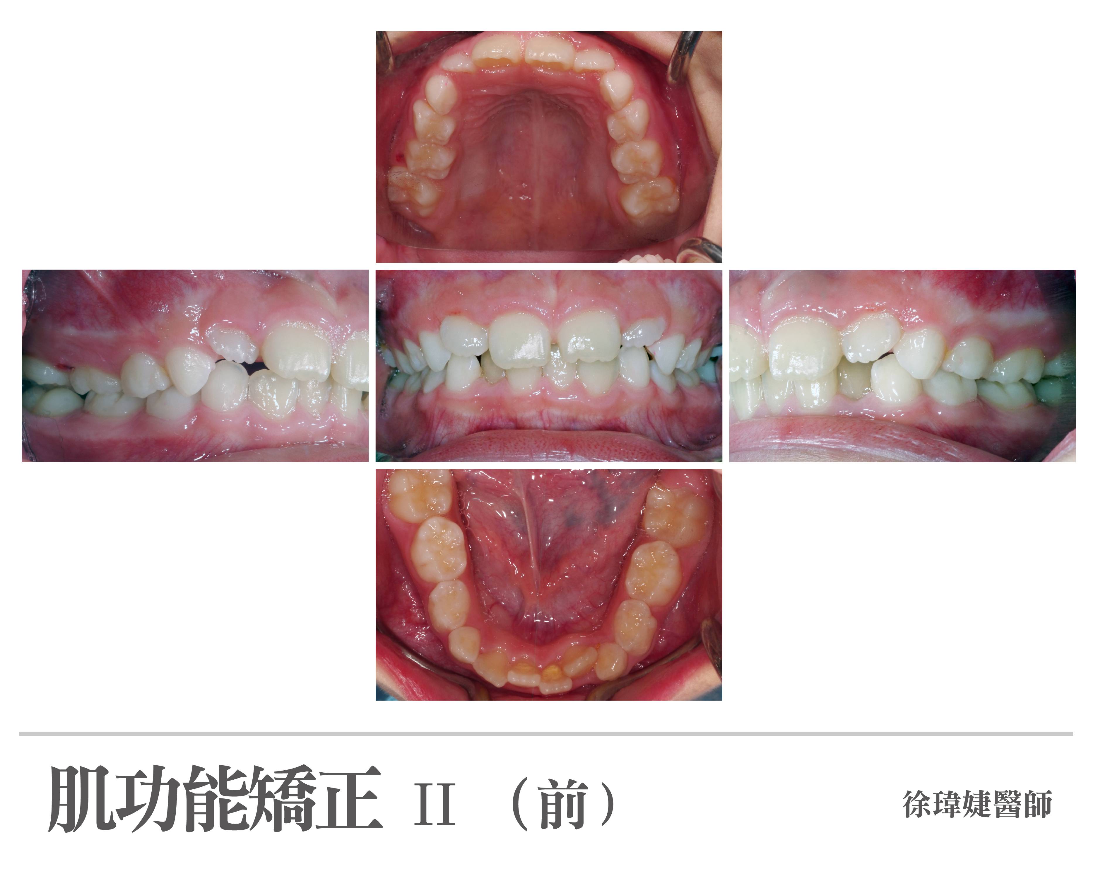 案例-2