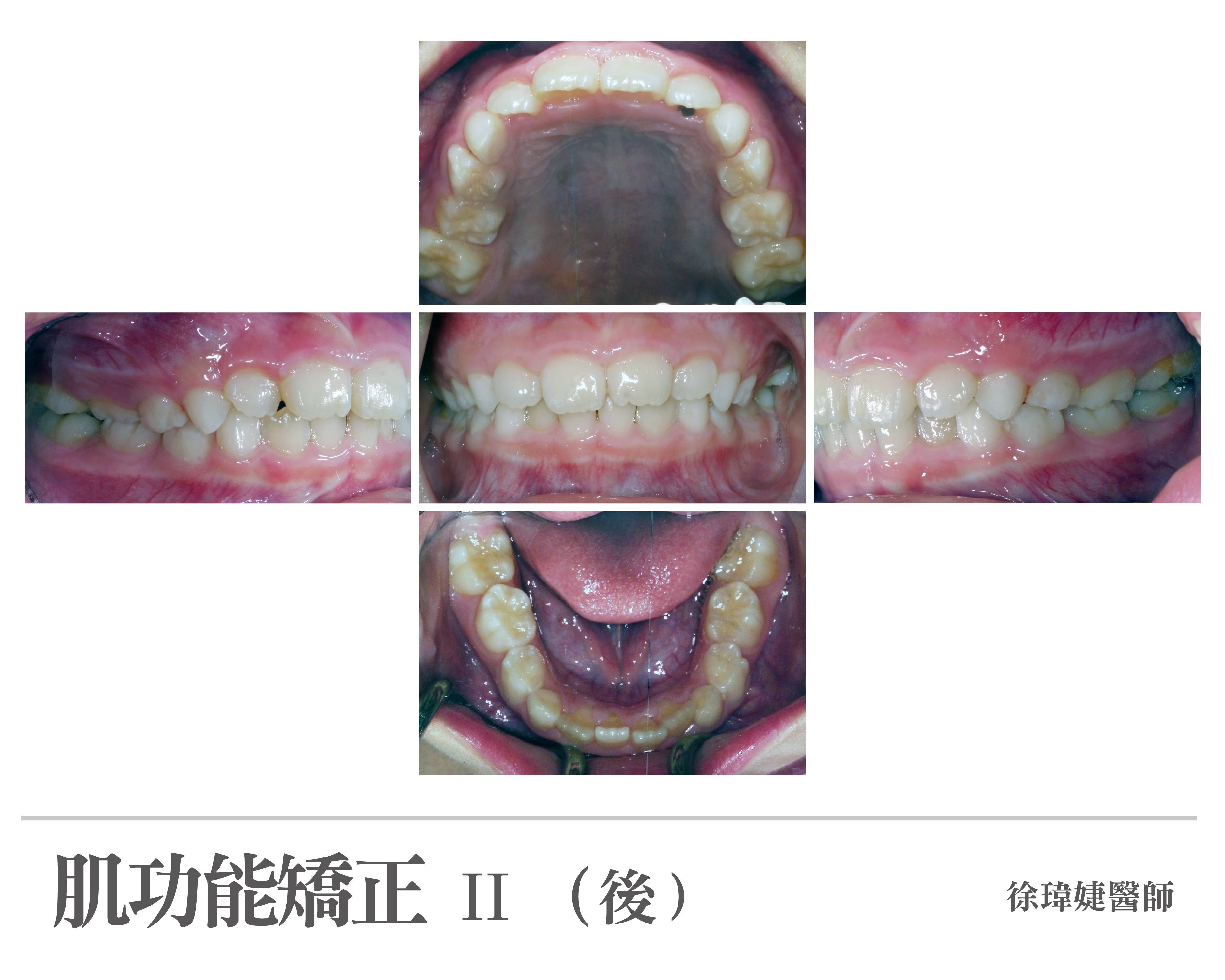 案例-3
