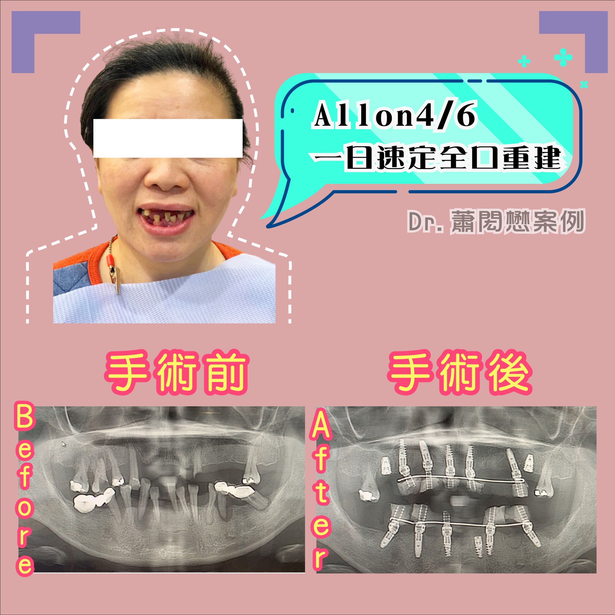 案例-1