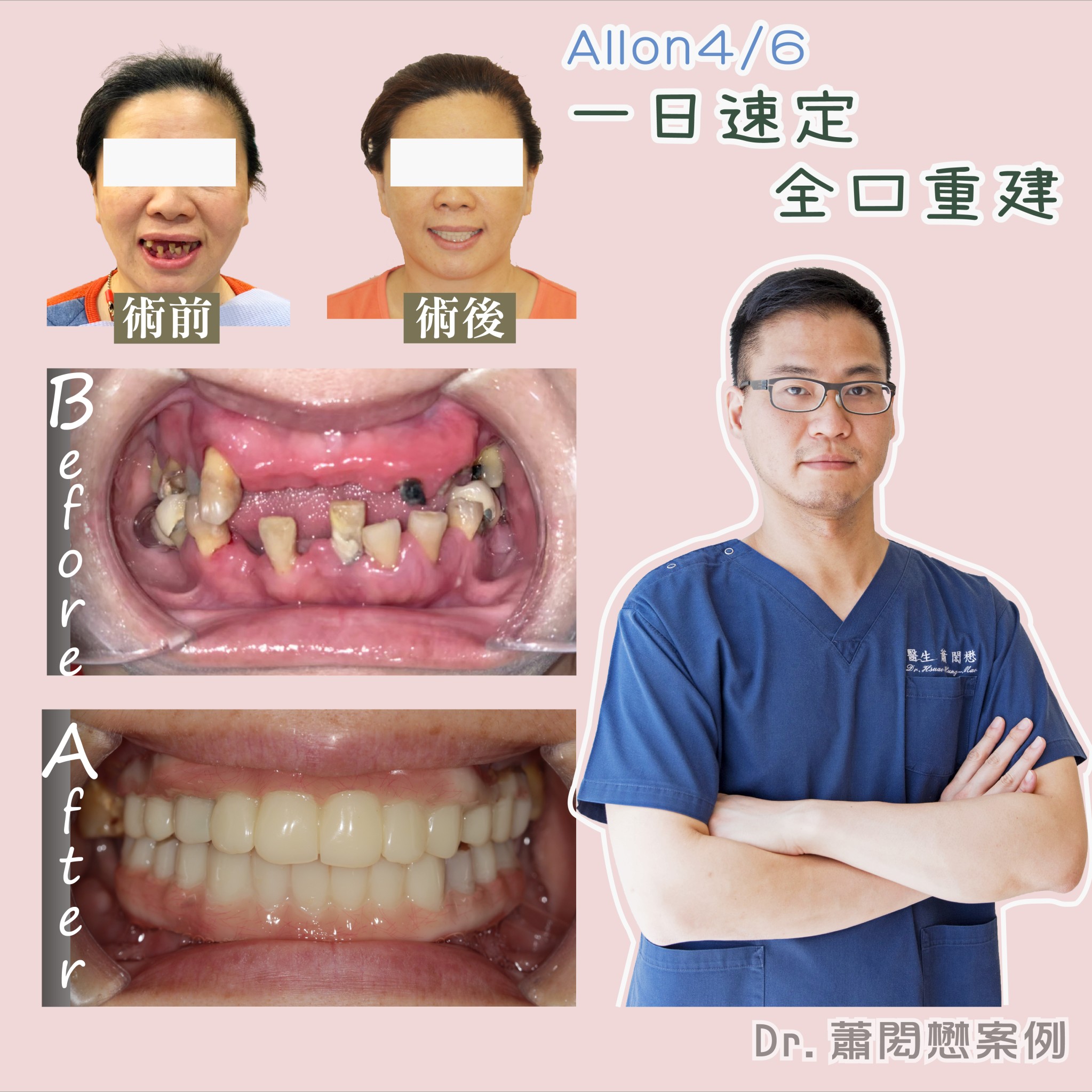 案例-2