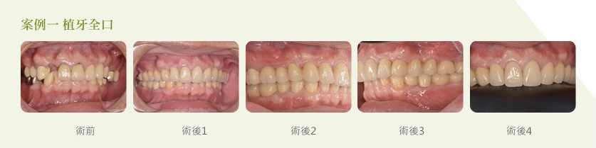 案例-2