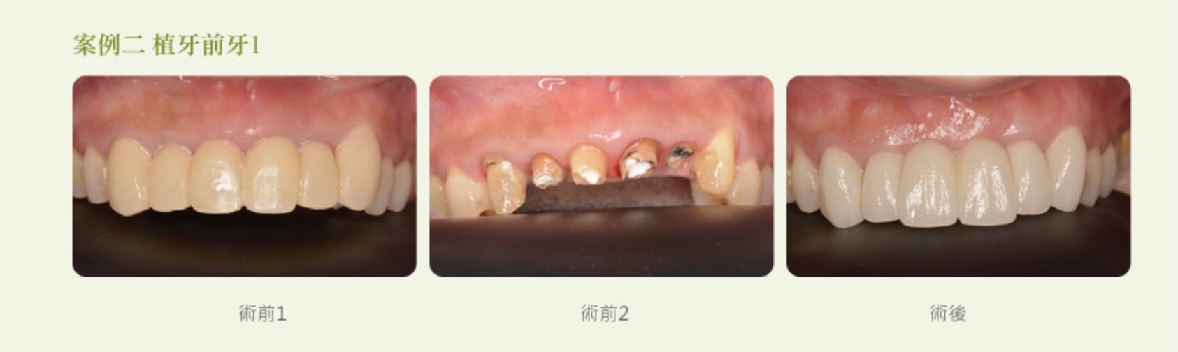 案例-3