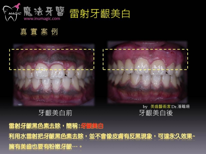 案例-2
