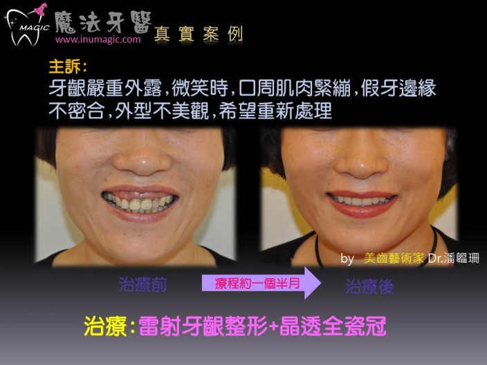 案例-3