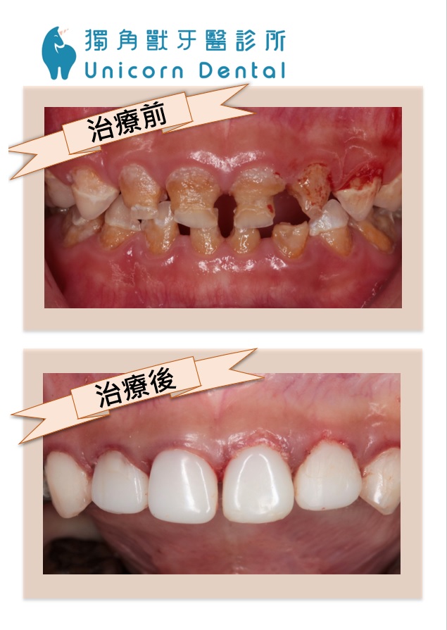 案例-3