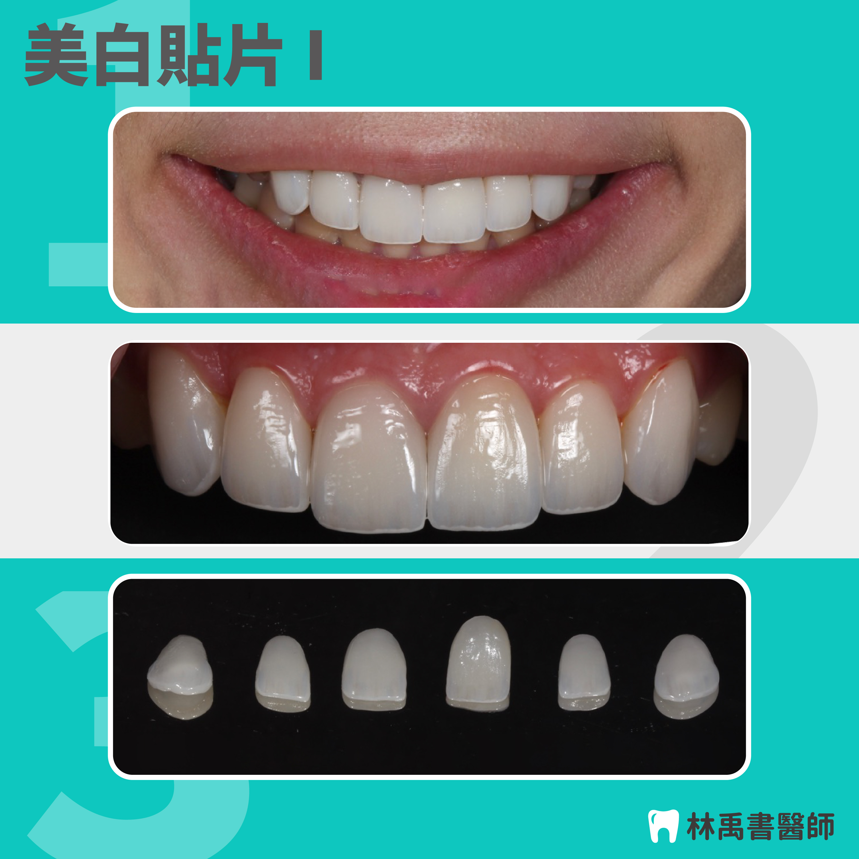 案例-1