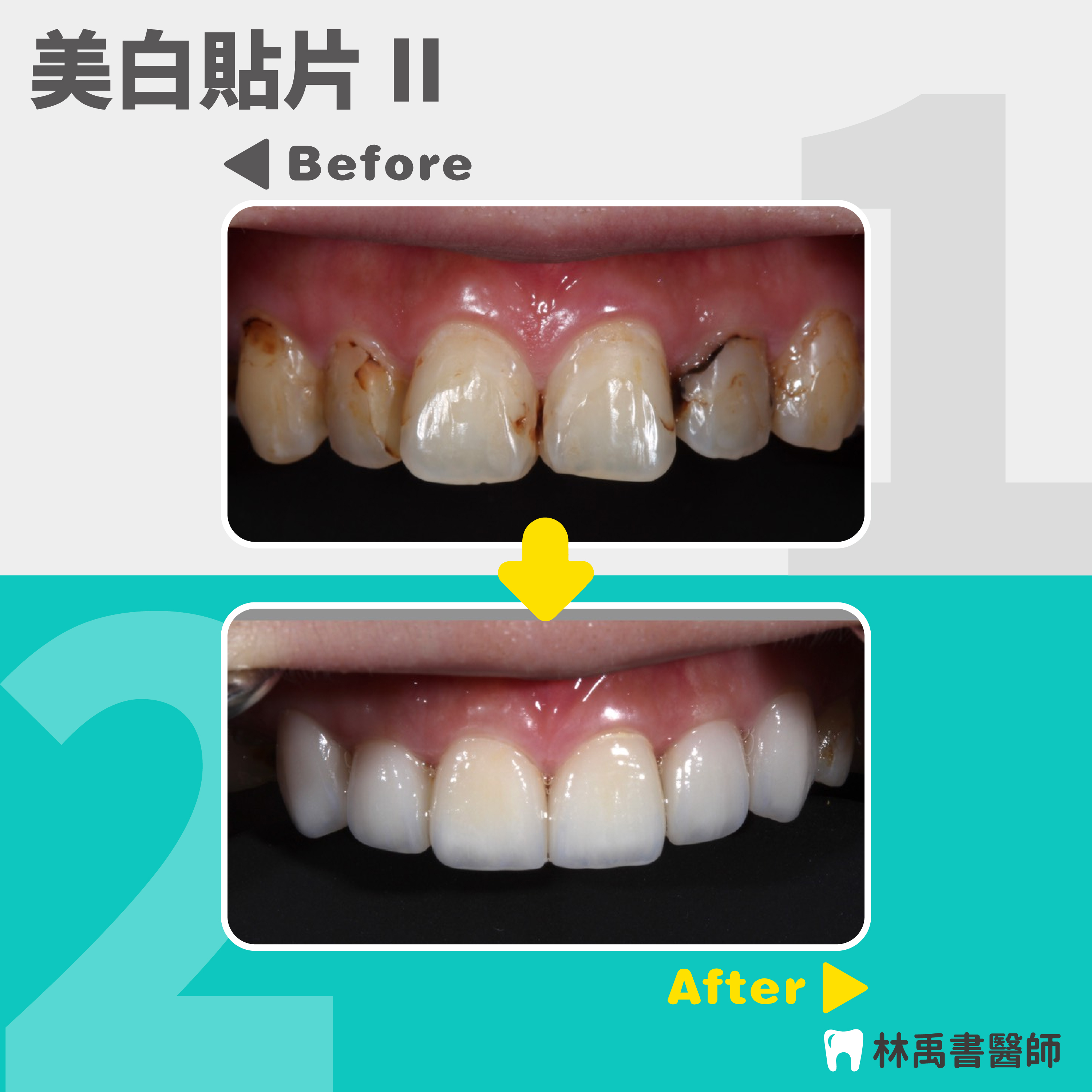 案例-2